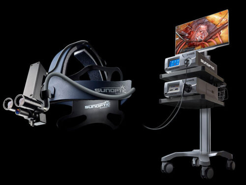 Sunoptic-surgical_HDC–300-HD-Headlight-Surgical-Camera