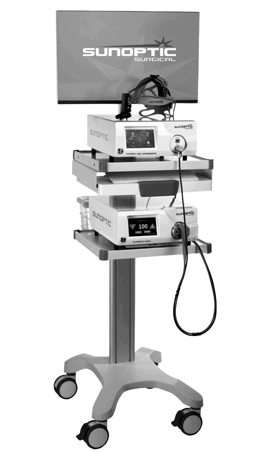 Sunoptic-surgical_HDC–300-HD-Headlight-Surgical-Camera-system-NOBG-BW